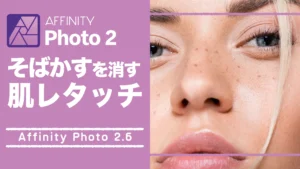 【Affinity Photo 2.6】そばかすを消す肌レタッチ方法